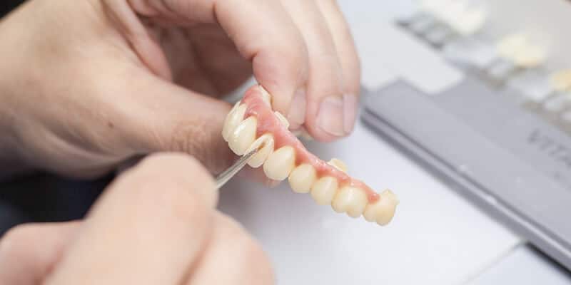 סט להשתלת שיניים