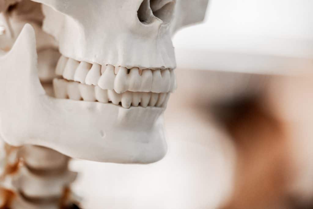 השתלת עצם בפה