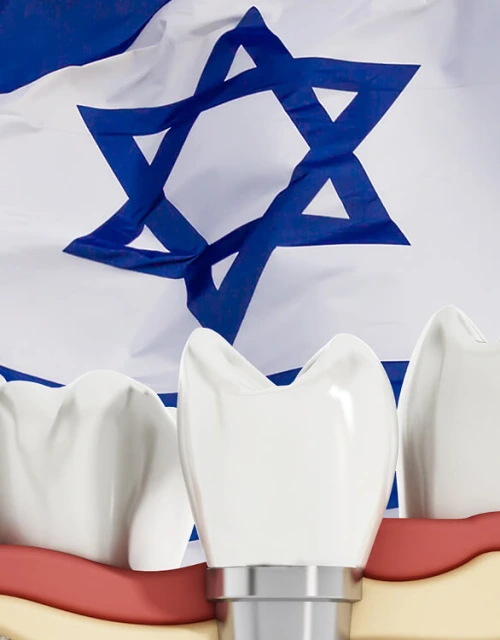 שתל ישראלי