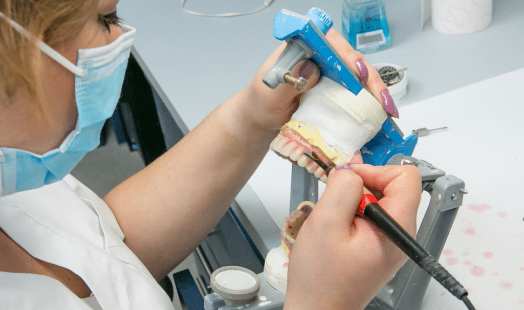 שיקום על גבי שתלים דורשת מעבדת שיניים מתקדמת