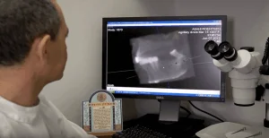 ד"ר בלן - השתלת שיניים