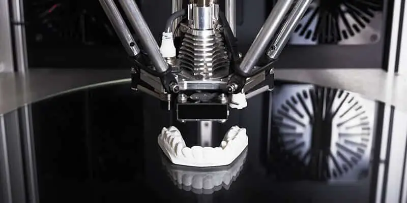 כמה עולה השתלת שיניים? איכות מעבדת השיניים גם היא משפיעה