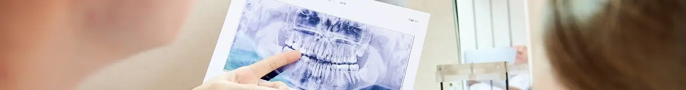 השתלת שיניים - ד