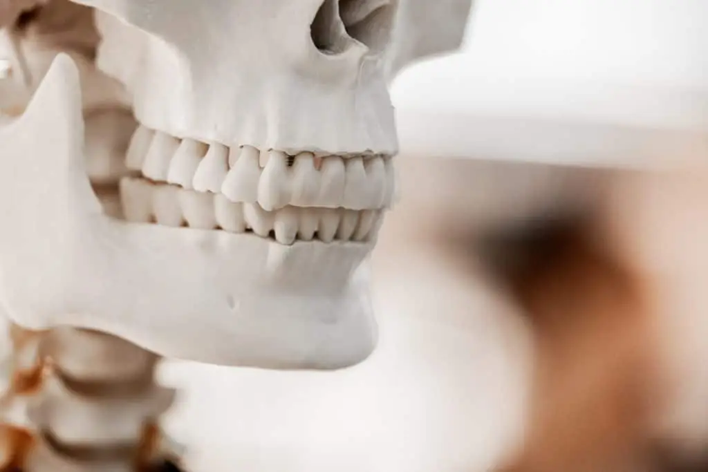 השתלת עצם בפה